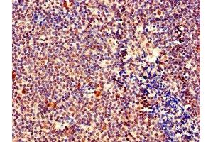 IHC image of ABIN7160506 diluted at 1:400 and staining in paraffin-embedded human tonsil tissue performed on a Leica BondTM system. (MEF2D antibody  (AA 299-509))