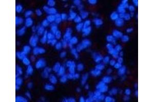 Immunofluorescence analysis of Rat lung tissue using Phospho-CHEK2 (Thr68) Polyclonal Antibody at dilution of 1:200 (CHEK2 antibody  (pThr68))