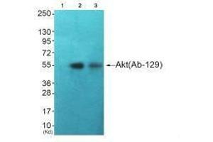 Western blot analysis of extracts from HuvEc cells (Lane 2) and JK cells (Lane 3), using Akt (Ab-129) antiobdy. (AKT1 antibody  (Ser129))