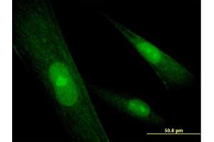 Immunofluorescence of purified MaxPab antibody to SRY on Hs 181. (SRY antibody  (AA 1-204))