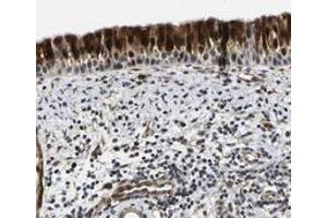 Immunohistochemical staining of human nasopharynx with C12orf35 polyclonal antibody  shows strong nuclear and cytoplasmic positivity in respiratory epithelial cells. (KIAA1551 antibody)