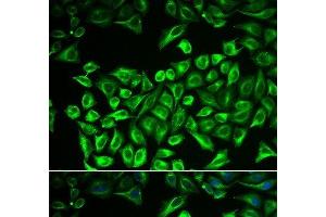 Immunofluorescence analysis of A549 cells using HAS3 Polyclonal Antibody (HAS3 antibody)