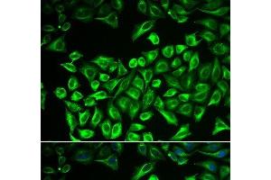 Immunofluorescence analysis of A549 cells using HAS3 Polyclonal Antibody (HAS3 antibody)