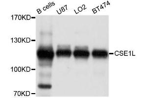 Western blot analysis of extracts of various cell lines, using CSE1L antibody. (Exportin 2 antibody  (AA 50-150))