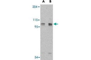 Western blot analysis of AOF2 in P815 cell lysate with AOF2 polyclonal antibody  at (A) 1 and (B) 2 ug/mL .