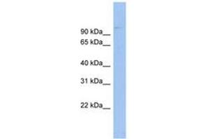 Image no. 1 for anti-ATP-Binding Cassette, Sub-Family B (MDR/TAP), Member 6 (ABCB6) (AA 431-480) antibody (ABIN6744718) (ABCB6 antibody  (AA 431-480))