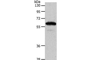 Western Blot analysis of Mouse brain tissue using INA Polyclonal Antibody at dilution of 1:550 (INA antibody)