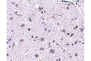 Immunohistochemistry (IHC) image for anti-Cerebral Dopamine Neurotrophic Factor (CDNF) (N-Term) antibody (ABIN1031315) (CDNF antibody  (N-Term))
