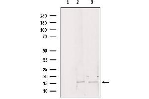 Western blot analysis of extracts from various samples, using CHCHD2 antibody. (CHCHD2 antibody  (Internal Region))