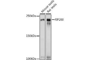 Western blot analysis of extracts of various cell lines, using FIP200 Rabbit pAb (ABIN7269881) at 1:1000 dilution. (FIP200 antibody  (C-Term))