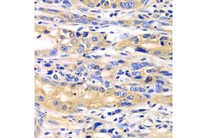 Immunohistochemistry (Paraffin-embedded Sections) (IHC (p)) image for anti-Seryl-tRNA Synthetase (SARS) (AA 1-300) antibody (ABIN6147383)