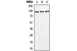 Western blot analysis of CD295 expression in MCF7 (A), HepG2 (B), HeLa (C) whole cell lysates.