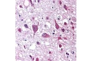 Staining of paraffin embedded human hypothalamus with sheep anti human Orexin A. (Orexin antibody  (AA 2-14))