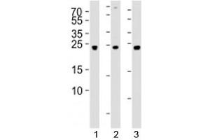 Western blot analysis of lysate from 1) 293, 2) SW620, and 3) U-87 MG cell line using UCHL3 antibody at 1:1000. (UCHL3 antibody  (AA 195-225))
