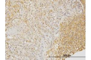 Image no. 1 for anti-Dihydropyrimidinase-Like 3 (DPYSL3) (AA 457-556) antibody (ABIN598653) (DPYSL3 antibody  (AA 457-556))