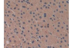 Immunohistochemistry (IHC) image for anti-Cytochrome C Oxidase Subunit II (COX2) (AA 418-589) antibody (ABIN7444103)
