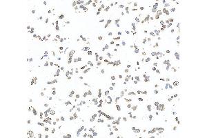 Immunocytochemistry (ICC) image for anti-AXL Receptor tyrosine Kinase (AXL) (AA 33-440) antibody (ABIN7453376) (Recombinant AXL antibody  (AA 33-440))