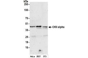 Western Blotting (WB) image for anti-Casein Kinase 2 alpha 1 (CSNK2A1) (AA 300-350) antibody (ABIN7454514)