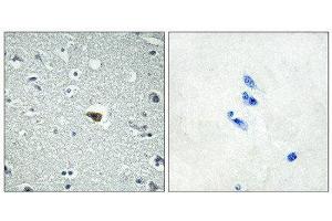 Immunohistochemistry (IHC) image for anti-Brain-Specific Angiogenesis Inhibitor 1 (BAI1) (Internal Region) antibody (ABIN6301192) (BAI1 antibody  (Internal Region))