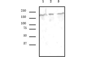SMARCA4 antibody (mAb) (Clone 5B7) tested by Western blot. (SMARCA4 antibody  (AA 213-295))