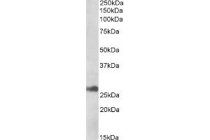 ABIN768557 (1µg/ml) staining of Human Liver lysate (35µg protein in RIPA buffer).