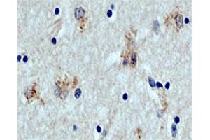DAB staining of ATG5 in paraffin - embedded human brain section (midfrontal cortex, Alzheimer case) using rabbit ATG5 polyclonal antibody  .