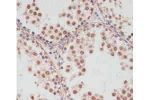 Immunohistochemistry of paraffin-embedded Rat testis using Phospho-PEA15(S104) Polyclonal Antibody at dilution of 1:100 (40x lens). (PEA15 antibody  (pSer104))