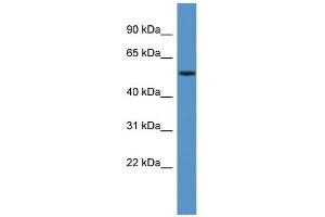 Western Blotting (WB) image for anti-Cytochrome P450, Family 3, Subfamily A, Polypeptide 5 (CYP3A5) (N-Term) antibody (ABIN2788347) (CYP3A5 antibody  (N-Term))