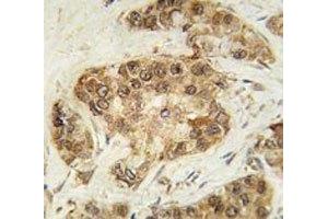 Immunohistochemistry (IHC) image for anti-Cyclin-Dependent Kinase 2 (CDK2) (AA 1-30) antibody (ABIN3030606)