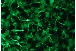 Immunocytochemistry (ICC) image for anti-Protein Kinase C, zeta (PRKCZ) antibody (ABIN870323) (PKC zeta antibody)