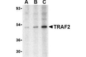 Western blot analysis of TRAF2 in human liver tissue lysate with this product at (A) 0.