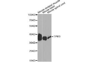 Western blot analysis of extracts of various cell lines, using TPM3 antibody (ABIN1875182) at 1:1000 dilution. (TPM3 antibody)