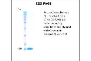 SDS-PAGE (SDS) image for Parathyroid Hormone (PTH) (Active) protein (ABIN5509381) (PTH Protein)
