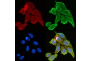 ABIN6260885 and ABIN6268761 staining Hela cells(30 min of UV treatment) by IF/ICC. (Claudin 6 antibody  (Internal Region))