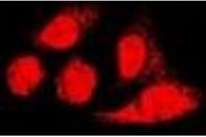 Immunofluorescent analysis of PA28 alpha staining in U2OS cells. (PSME1 antibody)