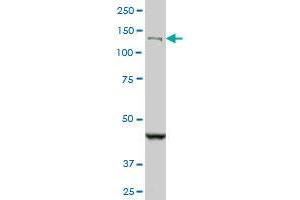 DHX8 monoclonal antibody (M07), clone 1D6. (DHX8 antibody  (AA 301-400))