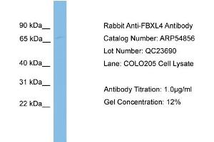 WB Suggested Anti-FBXL4  Antibody Titration: 0. (FBXL4 antibody  (N-Term))