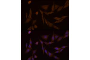 Immunofluorescence analysis of NIH/3T3 cells using PFKFB3 Rabbit mAb (ABIN1680620, ABIN3018306, ABIN3018307 and ABIN7101590) at dilution of 1:100 (40x lens). (PFKFB3 antibody)