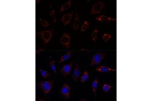 Immunofluorescence analysis of L929 cells using TBRG4 antibody  at dilution of 1:100. (TBRG4 antibody  (AA 382-631))
