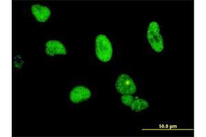 Immunofluorescence of monoclonal antibody to CPSF6 on HeLa cell. (CPSF6 antibody  (AA 37-136))