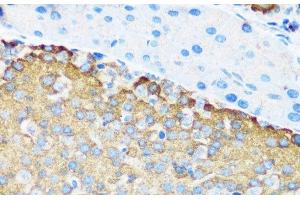 Immunohistochemistry of paraffin-embedded Mouse pancreatic islet using TSC1 Polyclonal Antibody at dilution of 1:200 (40x lens). (TSC1 antibody)