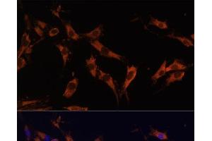 Immunofluorescence analysis of C6 cells using KSR1 Polyclonal Antibody at dilution of 1:100 (40x lens). (KSR1 antibody)