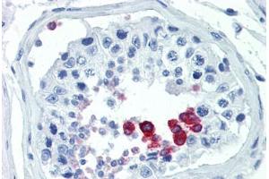 Human Testis (formalin-fixed, paraffin-embedded) stained with CCND1 antibody ABIN462139 followed by biotinylated goat anti-rabbit IgG secondary antibody ABIN481713, alkaline phosphatase-streptavidin and chromogen. (Cyclin D1 antibody  (Ser90))