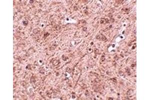 Immunohistochemistry (IHC) image for anti-Ceramide Synthase 6 (CERS6) (N-Term) antibody (ABIN1031437) (CERS6 antibody  (N-Term))