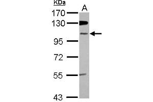Western Blotting (WB) image for anti-Zinc Finger Protein 512B (ZNF512B) (Internal Region) antibody (ABIN1493532)