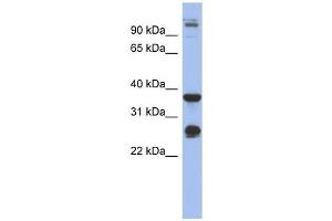 BGN antibody used at 1 ug/ml to detect target protein. (Biglycan antibody  (Middle Region))