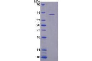 Image no. 1 for NLR Family, Pyrin Domain Containing 3 (NLRP3) (AA 671-1033) protein (His tag) (ABIN6238429) (NLRP3 Protein (AA 671-1033) (His tag))