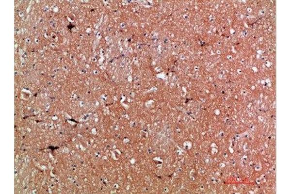 Tenascin R antibody  (AA 1270-1350)