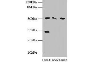 Western blot All lanes: SLC38A6 antibody at 12 μg/mL Lane 1: Mouse kidney tissue Lane 2: Mouse thymus tissue Lane 3: U87 whole cell lysate Secondary Goat polyclonal to rabbit IgG at 1/10000 dilution Predicted band size: 51, 58 kDa Observed band size: 51, 33 kDa (SLC38A6 antibody  (AA 132-169))