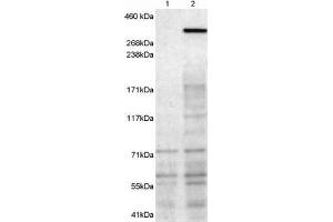 Western Blotting (WB) image for anti-Neurobeachin (NBEA) antibody (ABIN5872883) (Neurobeachin antibody)